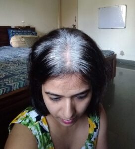 anjana's gray hair demarcation line india www.sparklingsilvers.com indian