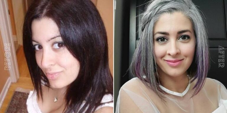 before and after grey hair pic