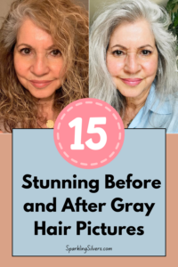 Before and after gray hair photos
